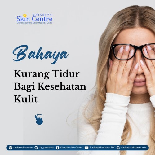 PostPhoto