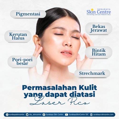 PostPhoto