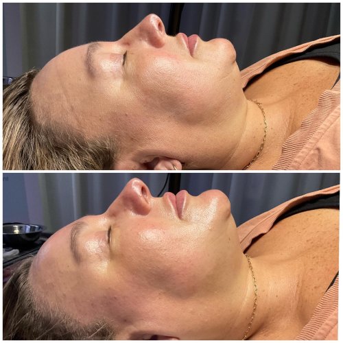 Photo post from lushaestheticsky.