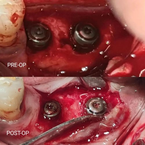 Carousel post from delhiperiodontist.