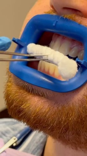 Video post from trilliumdental.