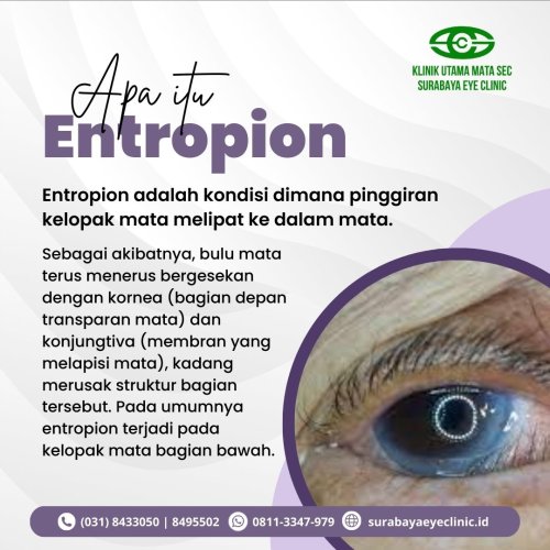 PostPhoto