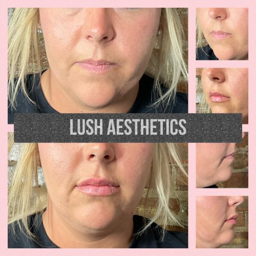 Photo post from lushaestheticsky.