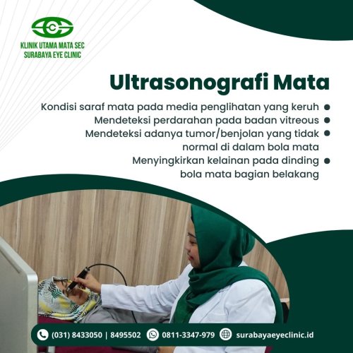 PostPhoto