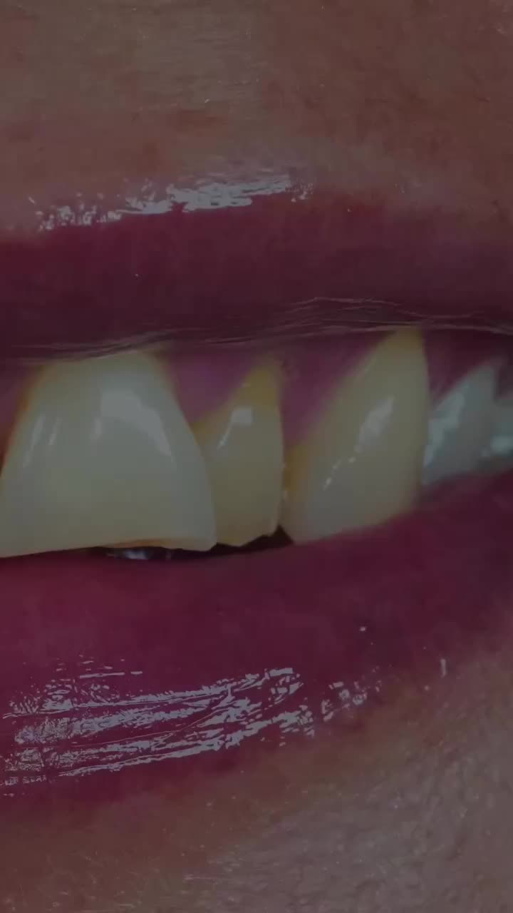 PostPhoto