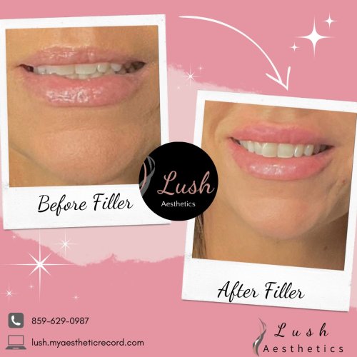 Photo post from lushaestheticsky.