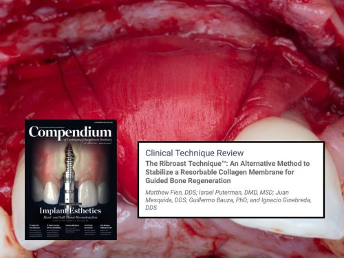 Photo post from fienodontics.