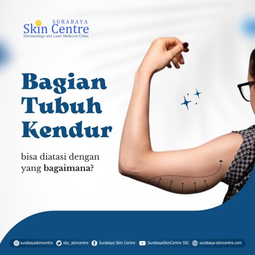 PostPhoto