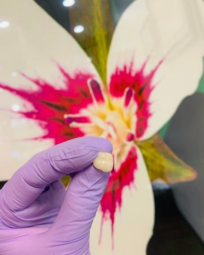 Photo post from trilliumdental.