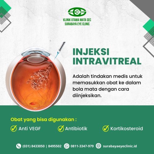PostPhoto