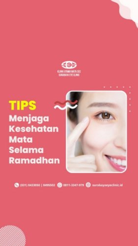 PostPhoto