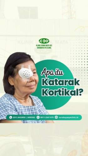 PostPhoto
