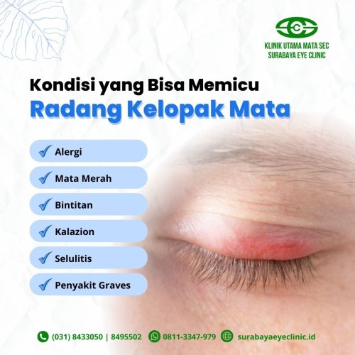 PostPhoto