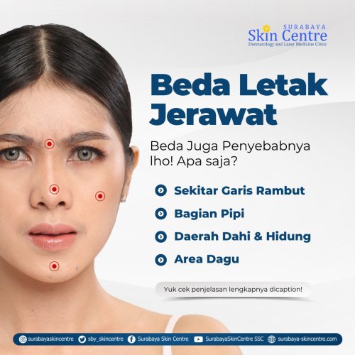 PostPhoto