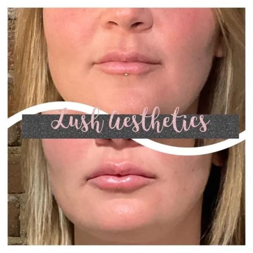 Photo post from lushaestheticsky.