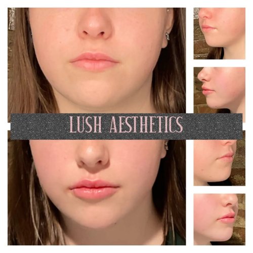 Photo post from lushaestheticsky.