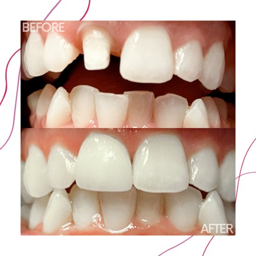 Photo post from trilliumdental.