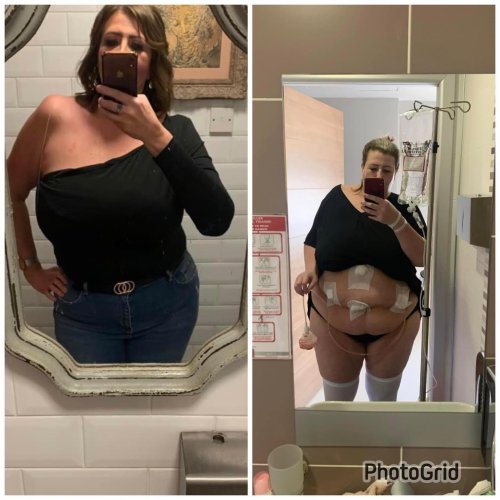 Photo post from antbariatric.