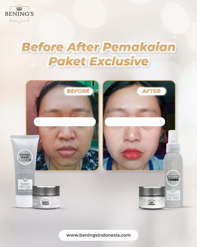 PostPhoto