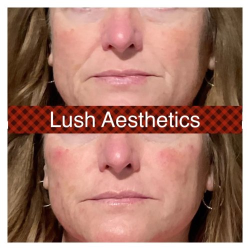 Photo post from lushaestheticsky.