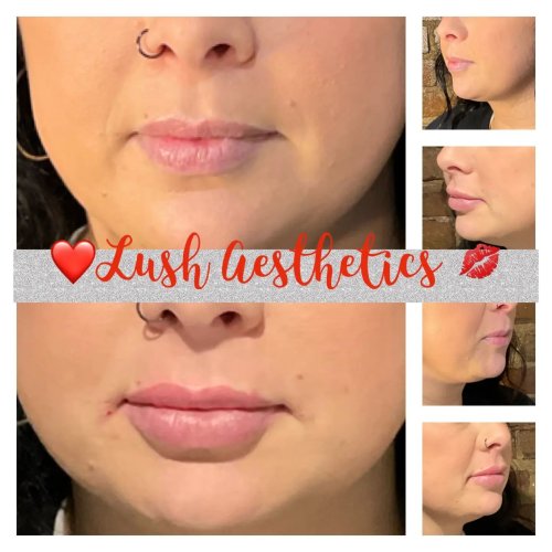 Photo post from lushaestheticsky.