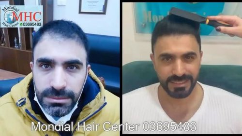 Video post from mondialhaircenter.