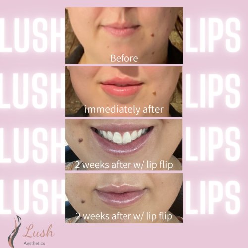 Photo post from lushaestheticsky.