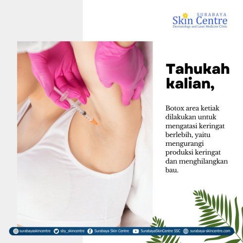 PostPhoto