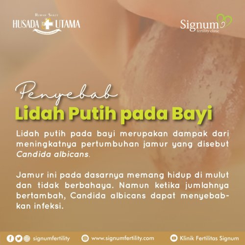 PostPhoto