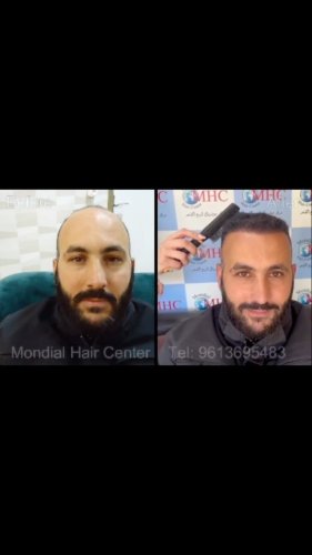 Video post from mondialhaircenter.