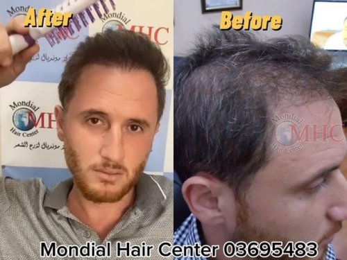 Video post from mondialhaircenter.