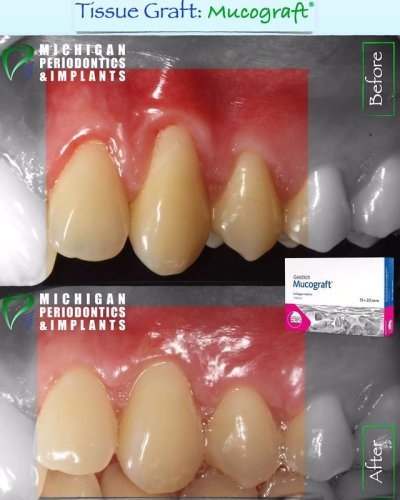 Video post from miperioimplant.