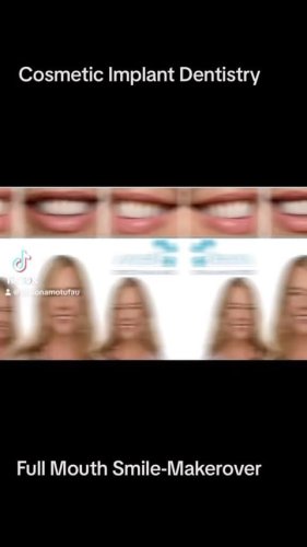 Video post from drsionamotufau.
