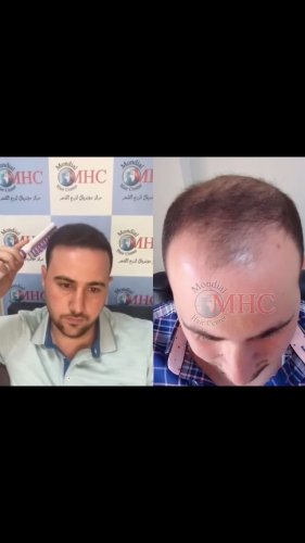 Video post from mondialhaircenter.