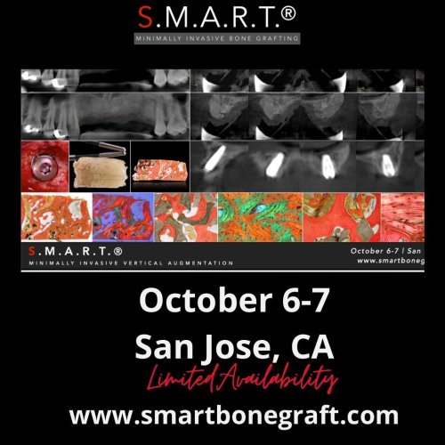 Photo post from smartbonegraft.