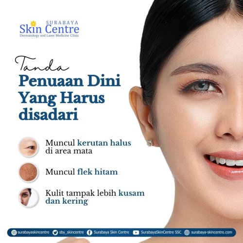 PostPhoto