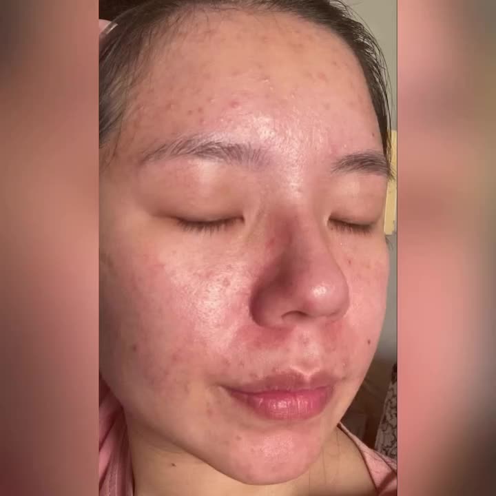 Video post from drcink.