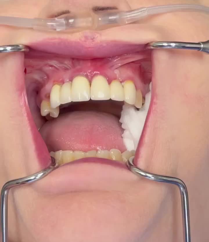 Carousel post from thefaceguys.