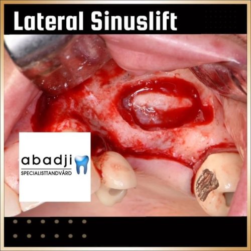 Video post from abadjispecialistdentistry.