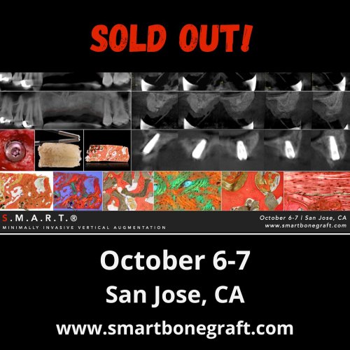Photo post from smartbonegraft.
