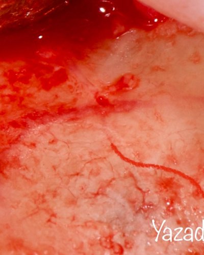 Carousel post from dentalmaxillofacial.