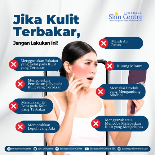 PostPhoto