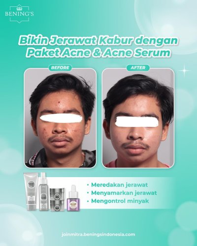PostPhoto