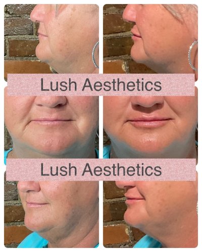 Photo post from lushaestheticsky.