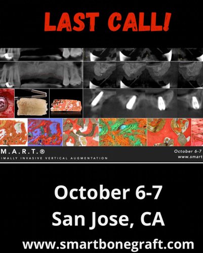 Photo post from smartbonegraft.