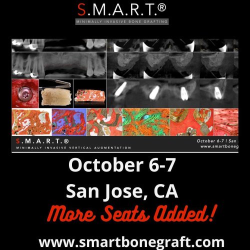Photo post from smartbonegraft.