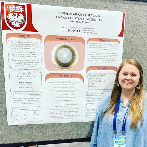 Carousel post from uchicagooptom.