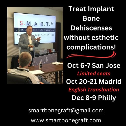 Photo post from smartbonegraft.