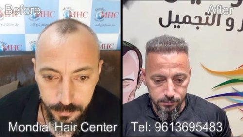 Video post from mondialhaircenter.