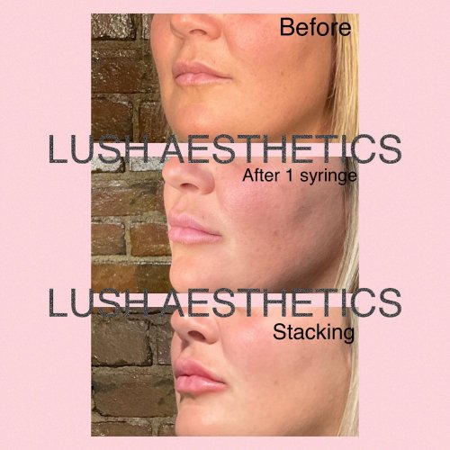 Photo post from lushaestheticsky.